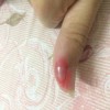 鸡眼是如何产生的