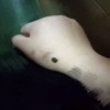 黑色素痣是怎么引起的