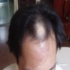 那么脱发有什么危害呢