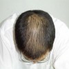 脱发具体给人们带来了哪些方面的危害