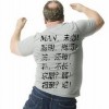 女性斑秃脱发怎样治疗