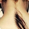 多毛症的危害具体有哪些