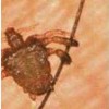 那阴虱病治疗如何