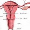 女性外阴黏膜白斑病的临床症状表现