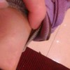 过度饮酒可导致脂肪瘤