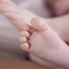 鸡眼如何诊断检查