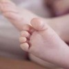 你真的了解鸡眼吗