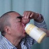 那些人容易患酒糟鼻