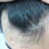 秋冬季吃什么可以缓解脱发