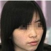 怎样有效预防雀斑