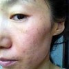 经常过敏是什么原因