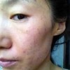 那到底什么是过敏呢