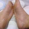 常见的引起脚气原因