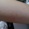 女性私处瘙痒的7大诱因