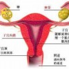 外阴白斑患者应该怎样调节心理压力