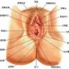 外阴白斑会遗传给后代吗