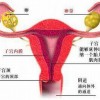 外阴白斑比较常见的有哪些症状