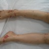 女人得性病有何特征