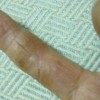 什么是手癣的全面介绍