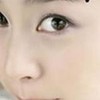 治疗色素痣该注意什么
