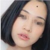 色素痣伤害有什么