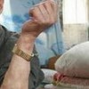 皮下脂肪瘤的相关问题