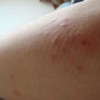 皮肤瘙痒患者常会出现哪些问题