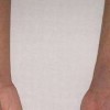 疤痕增生是什么引发的