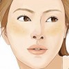 预防雀斑注意哪些事情