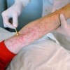 hiv是艾滋病吗