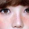 雀斑是否具有遗传特点