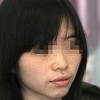利用激光去雀斑真的行吗