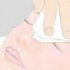 预防雀斑的发生