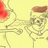 遗传性狐臭如何治疗
