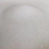 脂肪瘤的病发病因有什么呢