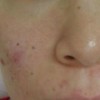 女性如何针对性的抵制黄褐斑