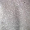 什么是性联遗传寻常鱼鳞病