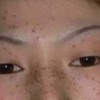 怎样预防雀斑的出现