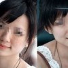 医生提示：雀斑病人注意生活护理