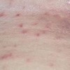 皮肤瘙痒对人体有什么危害