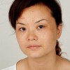 怎样避免雀斑变得更加严重