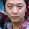 白斑病的初期病情都有什么呢呢 白斑病会出现哪些身体不舒服