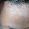 白斑的种类都有什么呢