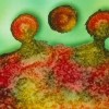 艾滋病潜伏期多久_艾滋病潜伏期症状