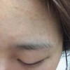 粉刺发病机理是什么呢