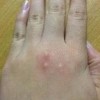 花草也可以帮助患者抵抗过敏吗