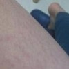 红血丝形成的原因是什么