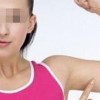 青春期引发的狐臭以后会消失吗