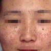 不做斑点女预防雀斑从生活细节开始