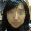 女性朋友如何防止雀斑
